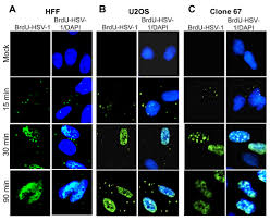 Hex rgb rgb % hsv cmyk. Ifi16 Restricts Hsv 1 Replication By Accumulating On The Hsv 1 Genome Repressing Hsv 1 Gene Expression And Directly Or Indirectly Modulating Histone Modifications