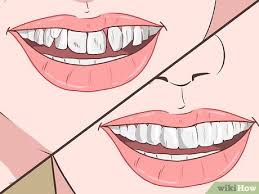 The remedies suggest that you don't have to use braces. How To Straighten Your Teeth Without Braces With Pictures