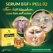 Mỹ Phẩm Trị Nám