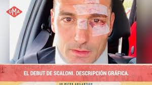 Find the newest colombia vs argentina meme. Copa America 2019 Los Memes De Argentina Vs Colombia En Su Primer Partido En El Torneo Goal Com