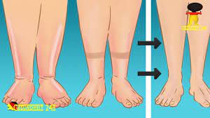 Geschwollene Beine Tipps Gegen Wasser In Den Beinen Youtube