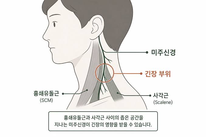 목 긴장이 자율신경에 미치는 영향 | Cervicovagopathy - 연세신명통증의학과