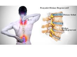 Aplikasi Marketing Terapi Punggung