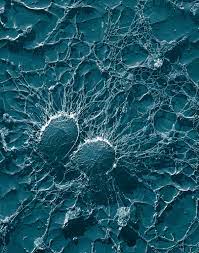 Staphylococcus Aureus Wikipedia