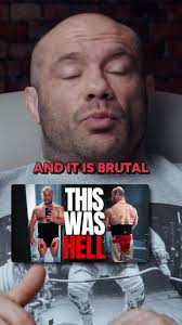 Surgery done! I had a ton of loose skin