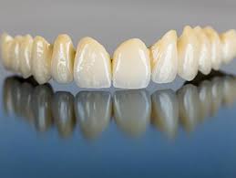 The biggest advantage of the ceramic restoration is its permanent aesthetic quality. Metal Ceramic Restoration Dental Laboratory Crh Oral Design