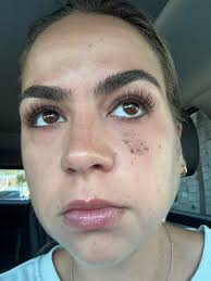 Since I get asked this all the time…. In public and online… people think  it's dirt, or mascara. It is FRECKLES. People have handed me napkins in  public for me to wipe