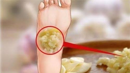 Chuyên gia Đông y chia sẻ: Trước khi đi ngủ đắp hai tép tỏi vào lòng bàn  chân, điều kỳ diệu xảy ra - Tạp chí Doanh Nghiệp Việt Nam