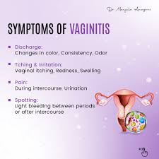 Image result for Vaginitis