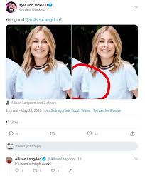 Today host allison langdon has given more details of the leg injuries she sustained while filming a tv segment on the gold coast on february 4. Nine S Today Host Allison Langdon Mysteriously Loses An Arm In Mega Pr Photoshop Fail B T