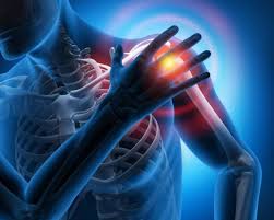Image result for Rotator Cuff Tendonitis
