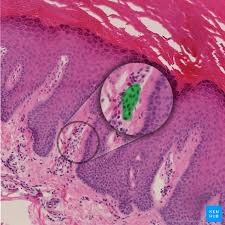 For those who have had sightings of. Peripheral Mechanoreceptors Ruffini Endings And More Kenhub