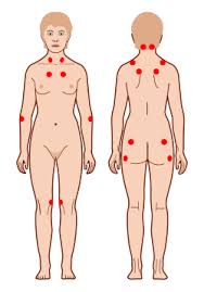 Image result for Tender Point