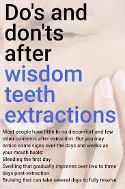 Pin On Dental Implants Cost People