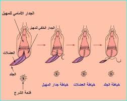 النحو التطبيقي (عالم الكتب الحديث) وفقاً لمقررات النحو العربي في المعاهد و الجامعات العربية المؤلف: Ø§Ù„Ø®ÙŠØ§Ø·Ù‡ Ø§Ù„ØªØ¬Ù…ÙŠÙ„ÙŠÙ‡ Ø§Ù„ØµÙØ­Ø© 3 Ø¹Ø§Ù„Ù… Ø­ÙˆØ§Ø¡