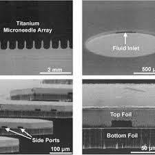 But skincare takes about a month to make a noticeable difference in your skin, goodman adds. Sems Of A Completed Microneedle Device Comprised Of Two Bonded 25 M Download Scientific Diagram