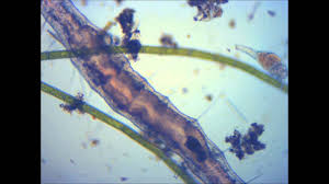 Microscopic Pond Life