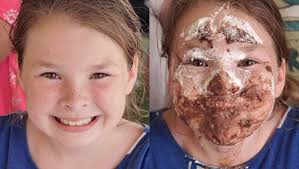 Livonia Spree Pie-Eating Contest, sponsored by the Livonia Observer