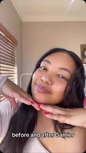 Skin routine using @garnier_sa every morning and every night., Using this  has definitely changed my skin and it’s brighter than ever! For the best  scar free skin, try using the serum twice a day. Try ...