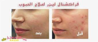 pin on العناية بالبشرة
