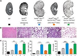 The Genetic Interaction Between Sec63 And Xbp1 In Polycystic Kidney Download Scientific Diagram