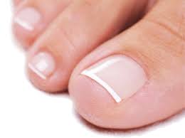 We did not find results for: Damaged Toenails Feet In Focus