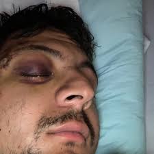 Fundraiser by Michael Perez Medina : Unexpected life event