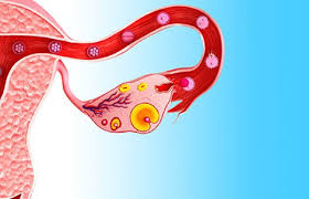 General term for cysts and cystic diseases of the ovary. Ovarian Cyst Symptoms Types And Treatment