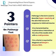 Image result for Pathergy