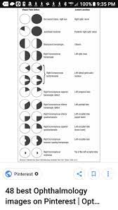 Pin By Shinjini Bose On Optometry Humor Optometry Eye Facts Eye Anatomy