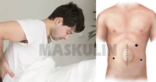 Aorta perut yakni pembuluh darah yang membawa darah dari. 5 Punca Jenis Hernia Pada Lelaki Hati Hati Kerana Penyakit Ini Boleh Jadi Bahaya Maskulin