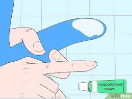 Should i get him circumcised? 3 Ways To Cure Balanitis Wikihow