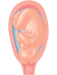 If this is your first baby, or if you have an epidural, labor could last longer. A Guide To The First Stage Of Labor Effacement And Dilation Familyeducation