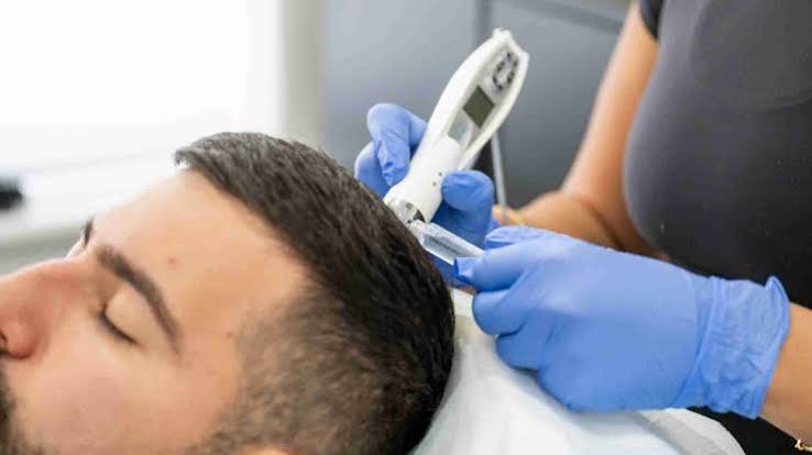 Exosome hair treatment consultation at Profrea