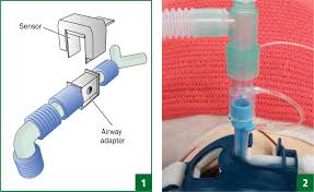 May be used for up to two hours of continuous use. Capnography Monitoring Co2 Journal Of Paramedic Practice
