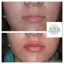 Aba_aestheticsbyadria