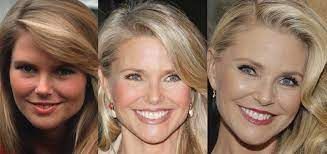 The stigma surrounding plastic surgery is disappearing as more mothers share their experiences, and why surg. Christie Brinkley Plastic Surgery Before And After Pictures 2021