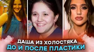 Действительно, ксения.в парике далеко не сразу узнала! Pobeditelnica Shou Holostyak 10 Do Plastiki Takuyu Dashu Ulyanovu Vy Ne Znali Stb Ukraina Youtube