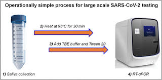 Saliva Based Molecular Testing For Sars Cov 2 That Bypasses Rna Extraction Biorxiv
