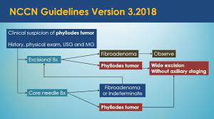 Surgery remains the mainstay of the treatment in patients with malignant phyllodes tumor of the breast (mptb); Epos C 1786