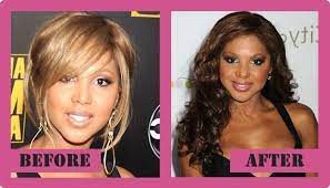 7.tamar braxton (before & after). Toni Braxton Plastic Surgery Coming To The Light