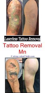 It is safe for all skin tones and works on virtually all inks. At Home Laser Tattoo Removal Colour Tattoo Removal Before And After How To Remove Childs Tattoo Tatto Laser Tattoo Tattoo Removal Cost Eyebrow Tattoo Removal