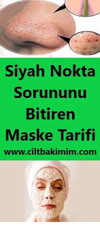 Siyah Nokta Sorununa Son Veren Maske