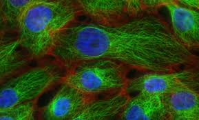 University of bonn | uni bonn · forschungsstelle für gesundheitskommunikation und versorgungsforschung, klinik und poliklinik für psychosomatische medizin und psychotherapie. Job Changes Following Breast Cancer Are Frequent In Some Cases Mediexpose