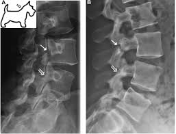 You may also use the spinolaminar line as a 2. A Review On Reading Lumbar X Rays Sports Medicine Review