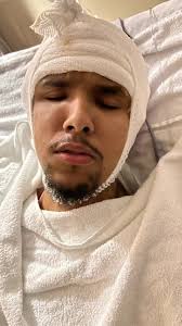 Ashton Coleman Head Injury Part 4