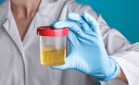 Urine Color Chart Interpretation