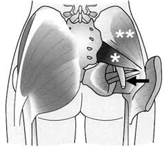 This article discusses symptoms, causes, treatments pain at the back of the thigh, foot, and calf; Common Diseases Mimicking Lumbar Disc Herniation And Their Treatment