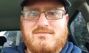 Rosehearty's "elephant man" prepared to have leg chopped off