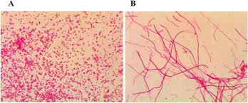 A microbial biorealm page on the genus salmonella typhimurium. Study On Antibiotic Susceptibility Of Salmonella Typhimurium L Forms To The Third And Forth Generation Cephalosporins Scientific Reports